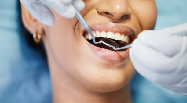 Best Same-Day Emergency Dental Services in Hapeville, GA